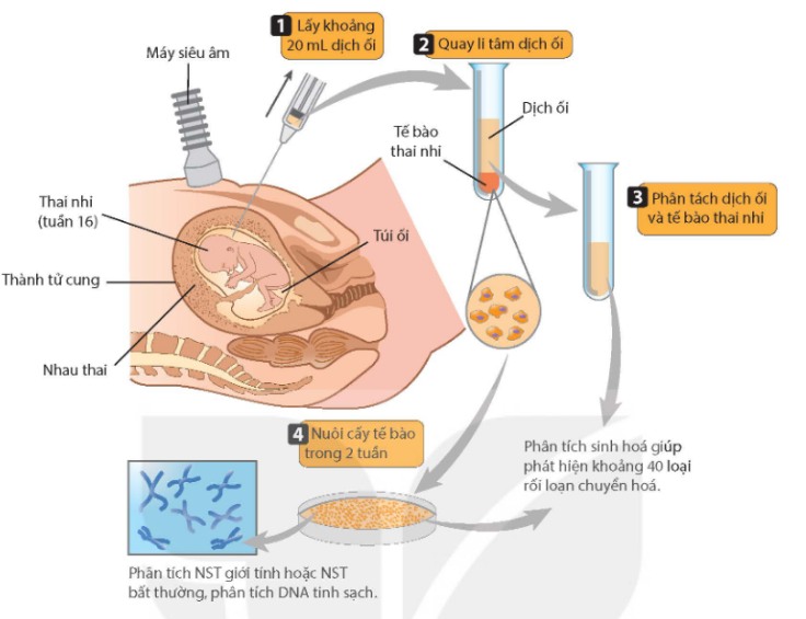 Kĩ thuật chọc lấy dịch ối