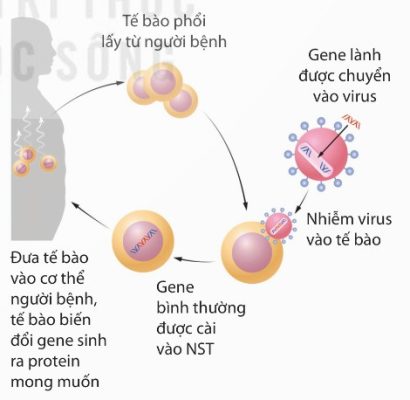Ứng dụng công nghệ di truyền trong liệu pháp gene ở người bị bệnh u xơ nang
